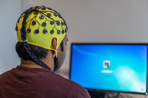 Electroencefalograma (EEG) 